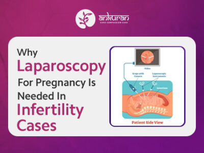 Why Laparoscopy for Pregnancy Is Needed in Infertility Cases