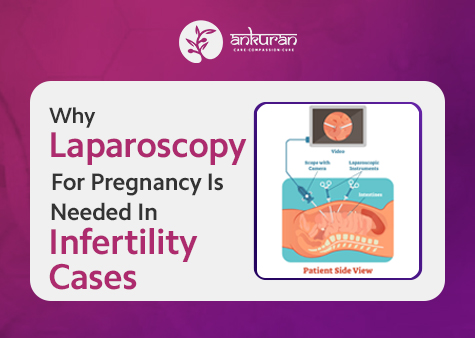 Why Laparoscopy for Pregnancy Is Needed in Infertility Cases