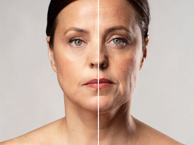 Best Skin Lifting Treatment In Patiala | Petals Aesthetics & Cosmetic Clinic