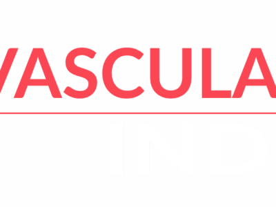 Best PET CT Scan Centre in Delhi | Easy Book My Lab