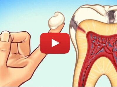 Fast Bad Breath Cure: Expert Tips for Fresh Oral Health