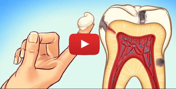 Fast Bad Breath Cure: Expert Tips for Fresh Oral Health
