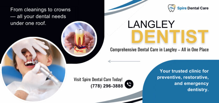 Langley Dentist 768x363