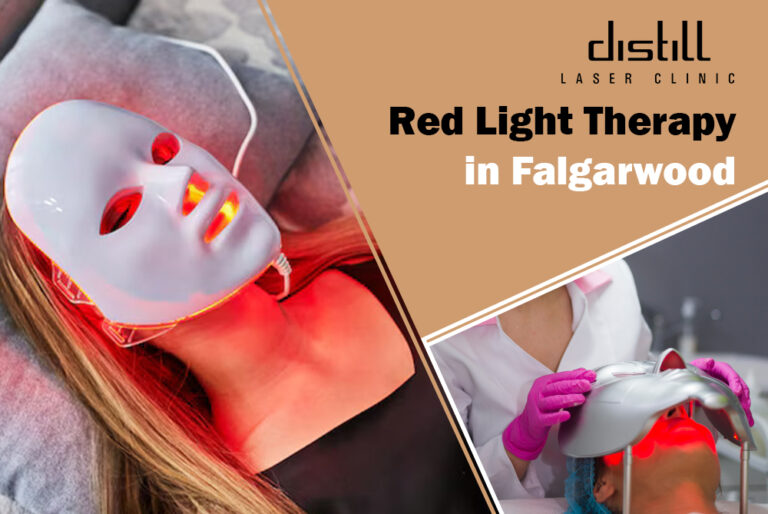 Red Light Therapy Oakville 768x514