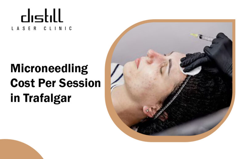 microneedling cost per session 768x514